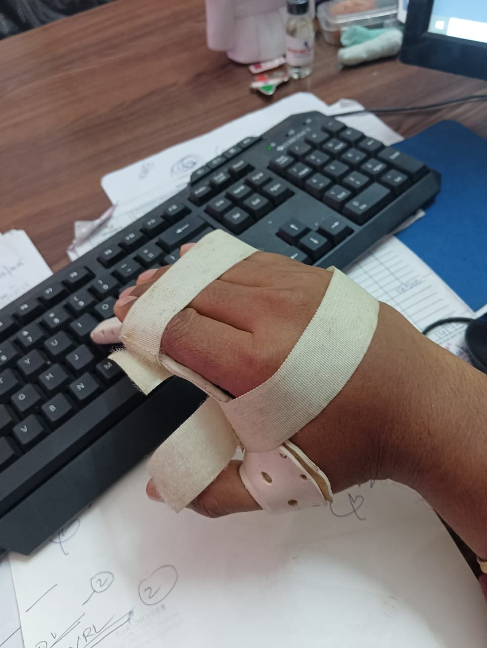KEYBOARD TYPING HAND SPLINT